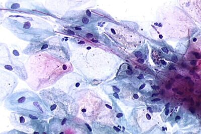 pruebas citopatologicas