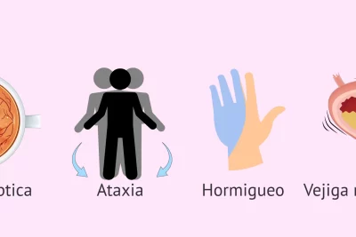 Esclerosis Múltiple