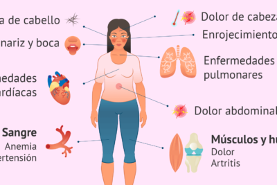 Lupus Eritematoso Sistémico
