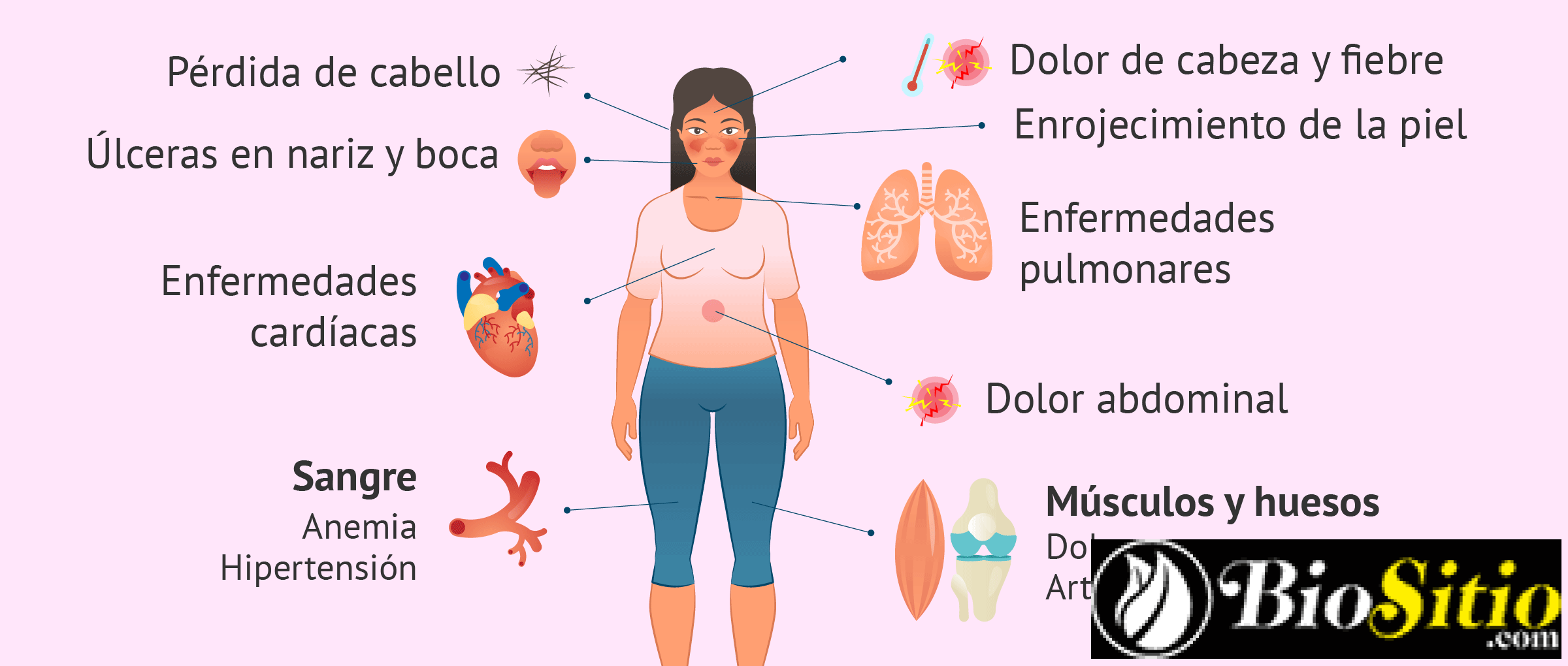 Lupus Eritematoso Sistémico