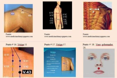 citopatología interventiva