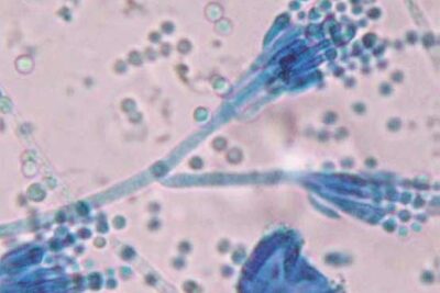 Penicillium Marneffei