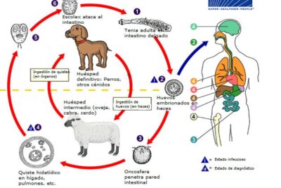 Echinococcus Granulosus