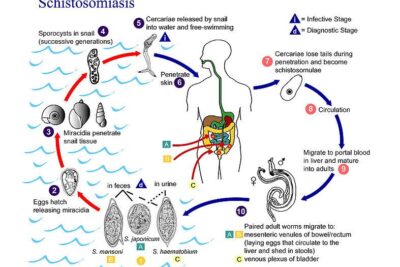 Schistosoma Mansoni