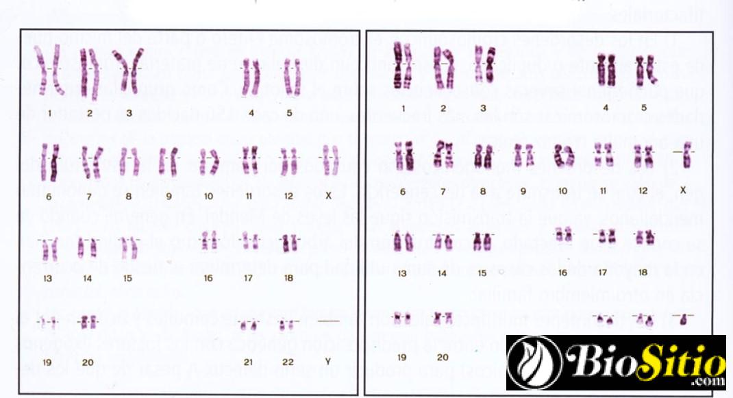 Citogenética: Estudio De Los Cromosomas Y Sus Alteraciones Genéticas ...